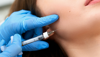 ボトックス治療