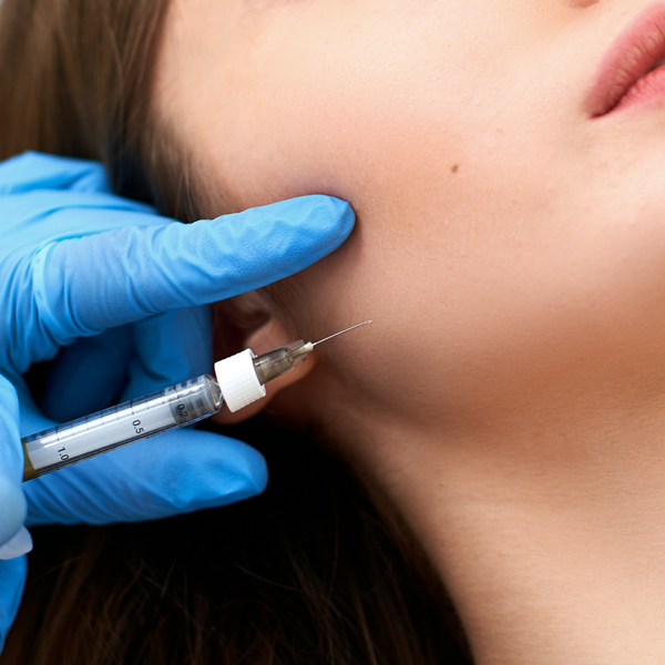 ボトックス治療